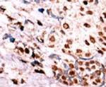 Phospho-c-Met (Tyr1349) Antibody in Immunohistochemistry (IHC)