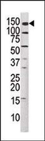 Phospho-c-Met (Tyr1349) Antibody in Western Blot (WB)