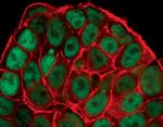 Phospho-p53 (Ser15) Antibody in Immunocytochemistry (ICC/IF)