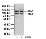 Progesterone Receptor Antibody in Western Blot (WB)