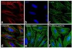 Mouse IgG (H+L) Secondary Antibody in Immunocytochemistry (ICC/IF)