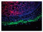 Rabbit IgG (H+L) Secondary Antibody in Immunocytochemistry (ICC/IF)