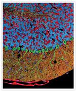 Rabbit IgG (H+L) Secondary Antibody in Immunohistochemistry (IHC)