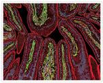 Rabbit IgG (H+L) Secondary Antibody in Immunohistochemistry (IHC)