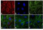 Rat IgG (H+L) Secondary Antibody in Immunocytochemistry (ICC/IF)