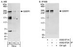 QSER1 Antibody in Western Blot (WB)
