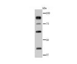 Glucocorticoid Receptor alpha Antibody in Western Blot (WB)