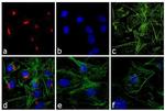 Rabbit IgG (H+L) Cross-Adsorbed Secondary Antibody in Immunocytochemistry (ICC/IF)