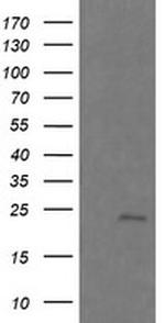 RAB21 Antibody in Western Blot (WB)