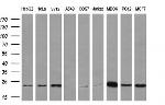 RAB21 Antibody in Western Blot (WB)