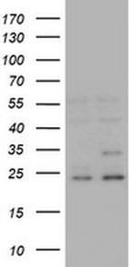 RAB21 Antibody in Western Blot (WB)