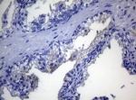 RAB3A Antibody in Immunohistochemistry (Paraffin) (IHC (P))