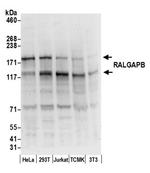 RALGAPB Antibody in Western Blot (WB)