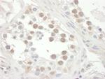 RAP1 Antibody in Immunohistochemistry (IHC)