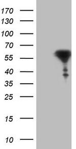 RARA Antibody in Western Blot (WB)