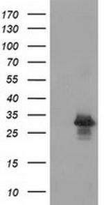 RASD2 Antibody in Western Blot (WB)