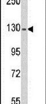 RASGRF1 Antibody in Western Blot (WB)