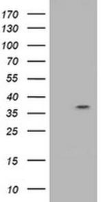 RASSF1 Antibody in Western Blot (WB)