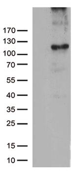 RB1 Antibody in Western Blot (WB)