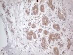 RBMS1 Antibody in Immunohistochemistry (Paraffin) (IHC (P))