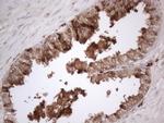 RBMS1 Antibody in Immunohistochemistry (Paraffin) (IHC (P))