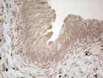 RBMS1 Antibody in Immunohistochemistry (Paraffin) (IHC (P))