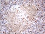 RBMS1 Antibody in Immunohistochemistry (Paraffin) (IHC (P))