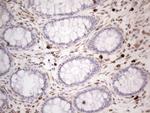 RBMS1 Antibody in Immunohistochemistry (Paraffin) (IHC (P))