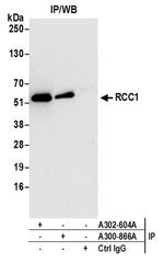 RCC1 Antibody in Western Blot (WB)
