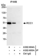 RCC1 Antibody in Immunoprecipitation (IP)