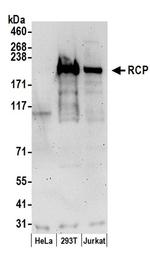 RCP Antibody in Western Blot (WB)