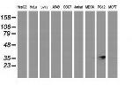 RDH14 Antibody in Western Blot (WB)