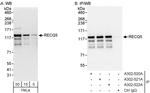 RECQ5 Antibody in Western Blot (WB)