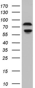 RELA Antibody in Western Blot (WB)