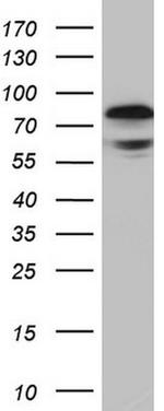 RELA Antibody in Western Blot (WB)
