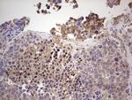 RET Antibody in Immunohistochemistry (Paraffin) (IHC (P))