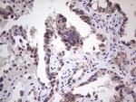 RET Antibody in Immunohistochemistry (Paraffin) (IHC (P))