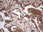 RET Antibody in Immunohistochemistry (Paraffin) (IHC (P))