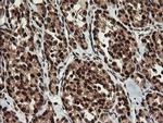 RFC2 Antibody in Immunohistochemistry (Paraffin) (IHC (P))