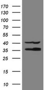 RFC2 Antibody in Western Blot (WB)