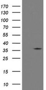 RFC2 Antibody in Western Blot (WB)