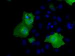 RIC8A Antibody in Immunocytochemistry (ICC/IF)