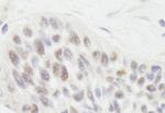 RIF1 Antibody in Immunohistochemistry (IHC)