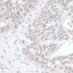 RIF1 Antibody in Immunohistochemistry (IHC)