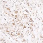 RIF1 Antibody in Immunohistochemistry (IHC)