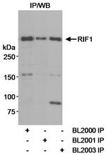 RIF1 Antibody in Immunoprecipitation (IP)