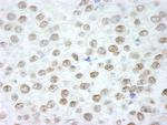 RIF1 Antibody in Immunohistochemistry (IHC)