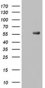 RIPK3 Antibody in Western Blot (WB)
