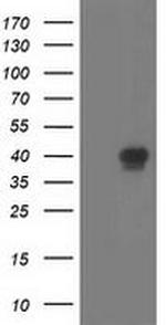RLBP1 Antibody in Western Blot (WB)