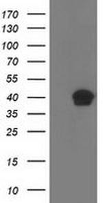 RLBP1 Antibody in Western Blot (WB)